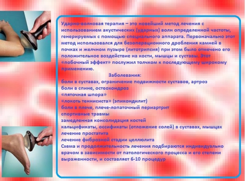 Ударно-волновая терапия - Татьяна Викторовна Казанкова